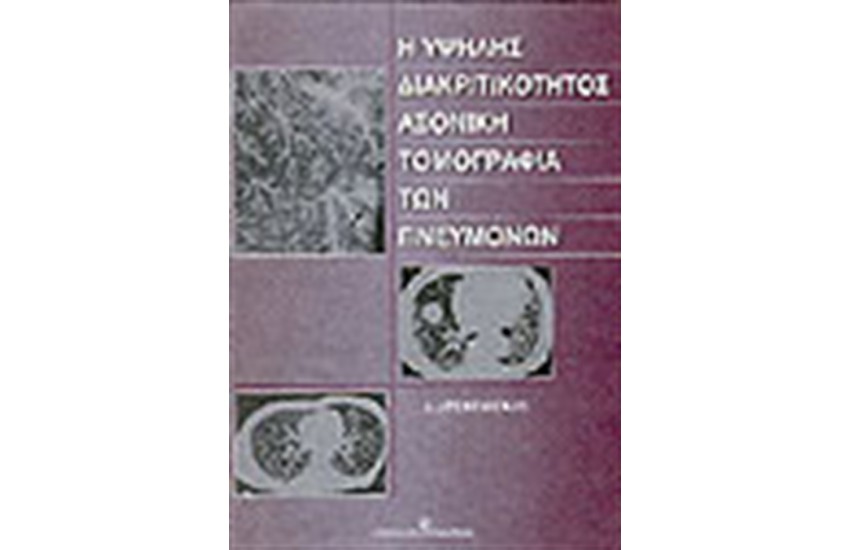 ΥΨΗΛΗΣ ΔΙΑΚΡΙΤΙΚΟΤΗΤΟΣ ΑΞΟΝΙΚΗ ΤΟΜΟΓΡΑΦΙΑ ΤΩΝ ΠΝΕΥΜΟΝΩΝ