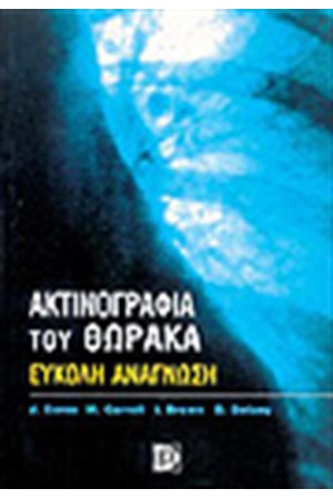 ΑΚΤΙΝΟΓΡΑΦΙΑ ΤΟΥ ΘΩΡΑΚΑ