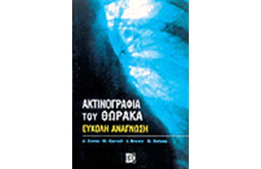 ΑΚΤΙΝΟΓΡΑΦΙΑ ΤΟΥ ΘΩΡΑΚΑ
