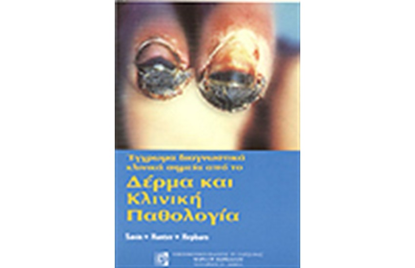 ΔΕΡΜΑ ΚΑΙ ΚΛΙΝΙΚΗ ΠΑΘΟΛΟΓΙΑ