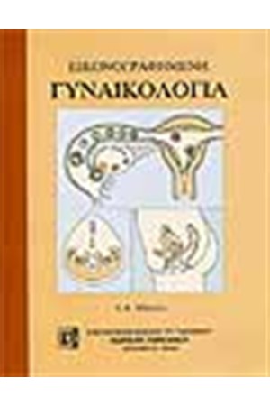 ΕΙΚΟΝΟΓΡΑΦΗΜΕΝΗ ΓΥΝΑΙΚΟΛΟΓΙΑ