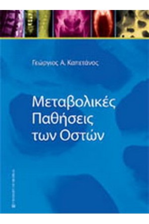 ΜΕΤΑΒΟΛΙΚΕΣ ΠΑΘΗΣΕΙΣ ΤΩΝ ΟΣΤΩΝ