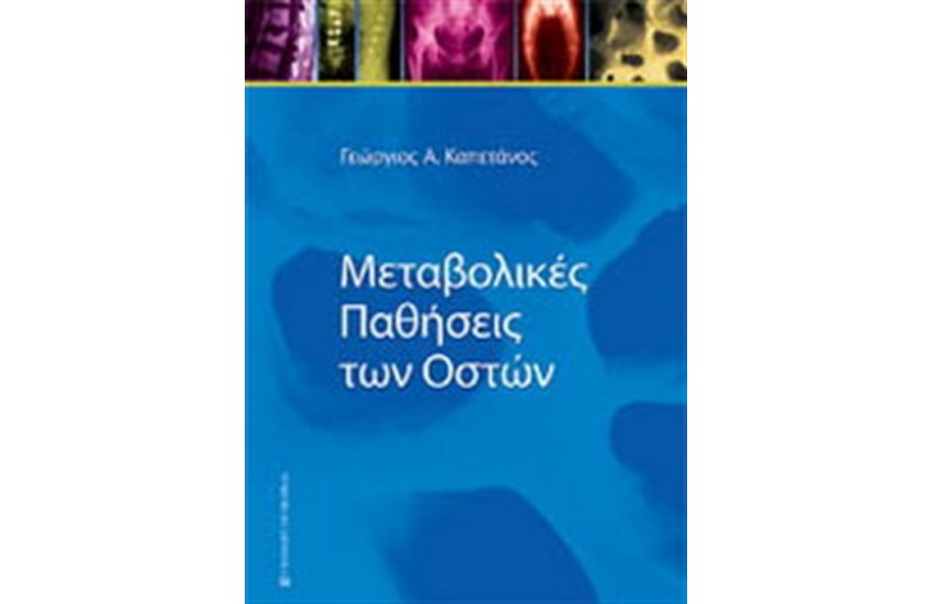 ΜΕΤΑΒΟΛΙΚΕΣ ΠΑΘΗΣΕΙΣ ΤΩΝ ΟΣΤΩΝ