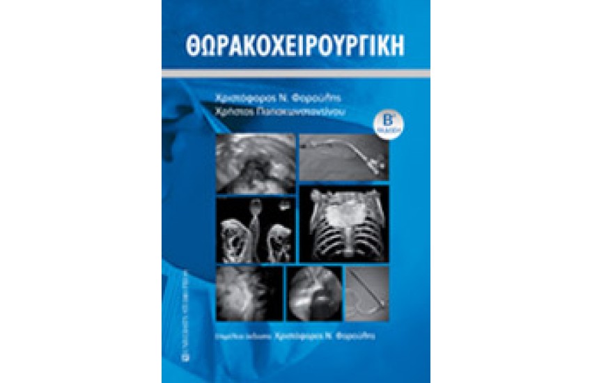ΘΩΡΑΚΟΧΕΙΡΟΥΡΓΙΚΗ Β' ΕΚΔΟΣΗ