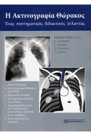 Η ΑΚΤΙΝΟΓΡΑΦΙΑ ΘΩΡΑΚΟΣ