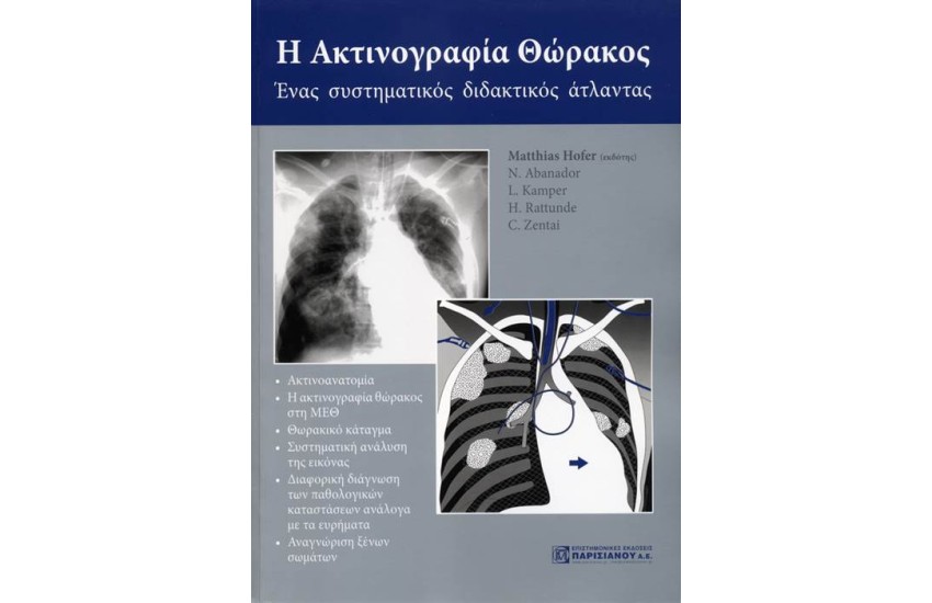 Η ΑΚΤΙΝΟΓΡΑΦΙΑ ΘΩΡΑΚΟΣ