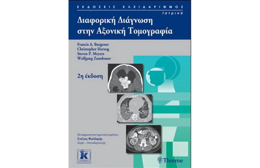 ΔΙΑΦΟΡΙΚΗ ΔΙΑΓΝΩΣΗ ΣΤΗΝ ΑΞΟΝΙΚΗ ΤΟΜΟΓΡΑΦΙΑ 2η ΕΚΔΟΣΗ