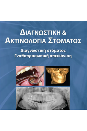 ΔΙΑΓΝΩΣΤΙΚΗ ΚΑΙ ΑΚΤΙΝΟΛΟΓΙΑ ΣΤΟΜΑΤΟΣ ΔΙΑΓΝΩΣΤΙΚΗ ΣΤΟΜΑΤΟΣ ΓΝΑΘΟΠΡΟΣΩΠΙΚΗ ΑΠΕΙΚΟΝΙΣΗ