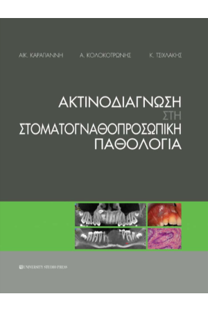 ΑΚΤΙΝΟΔΙΑΓΝΩΣΗ ΣΤΗ ΣΤΟΜΑΤΟΓΝΑΘΟΠΡΟΣΩΠΙΚΗ ΠΑΘΟΛΟΓΙΑ