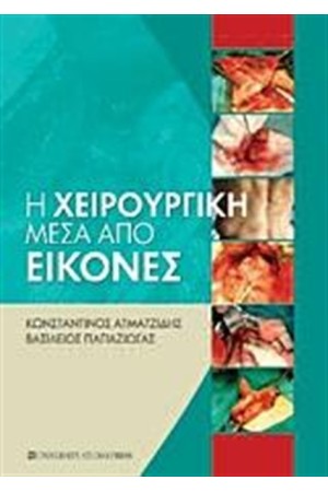 Η ΧΕΙΡΟΥΡΓΙΚΗ ΜΕΣΑ ΑΠΟ ΕΙΚΟΝΕΣ